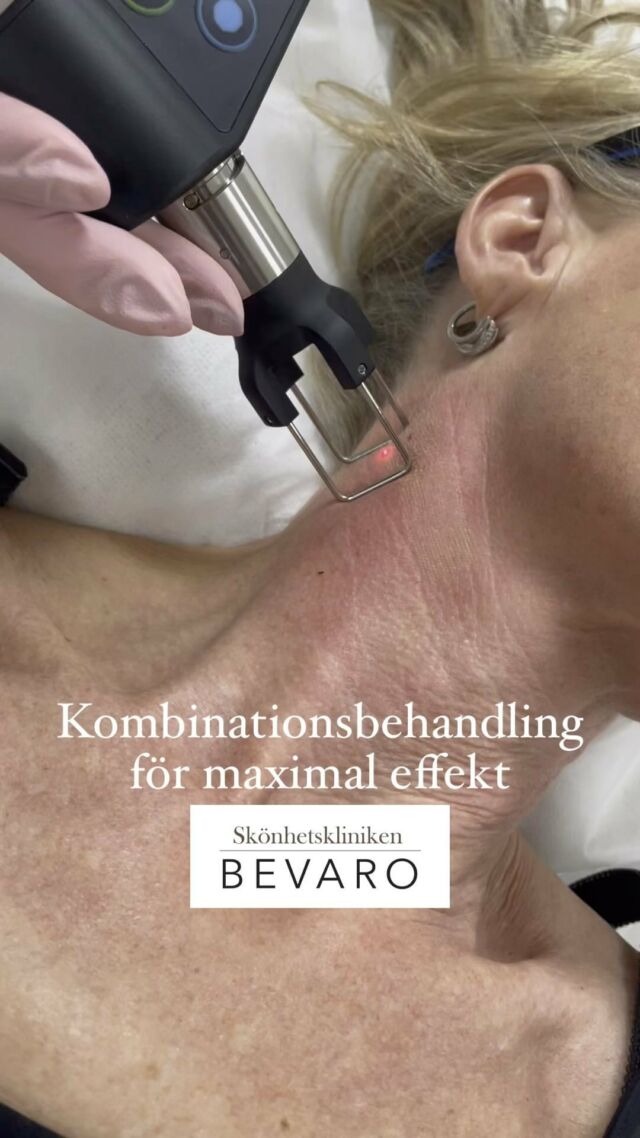 Visste du att vi alltid skräddarsyr behandlingarna för just dig, efter dina förutsättningar och behov?

Här har vi först gjort en ultracol💉 innan 
Co2-laser💥för att få maximal effekt❤️

Vill du veta vad vi kan göra för just dig? 

Boka en kostnadsfri konsultation🌸

💻 www.skonhetskliniken.se
☎️ 031-7118877
📧 info@skonhetskliniken.se
📍Götabergsgatan 3, Göteborg
🏆 Alla behandlare är legitimerade👩🏼‍🎓 Vi utbildar i alla tekniker 

#laser #co2laser #deka #dekasmartxidepunto #fraktioneradlaser #lasergbg #lasergöteborg #smartxidepunto #skönhetsklinikenbevaro
#fillers #fillersgbg #nofilter #sunekos200 #sunekos #nutrakos #restylane #juvederm #katarinajochems #skonhetskliniken #teosyal #injektionsspecilist ##botox #azzalur #fillerinjektions #nofilter #sjuksköterska #vistabel #katarina_skonhetskliniken #läkare